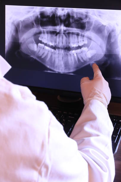 Best Emergency Treatment for Dental Infections or Abscesses in Packanack Lake, NJ
